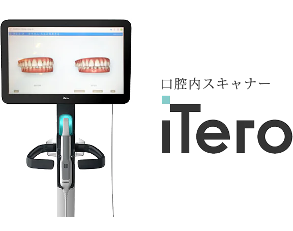 iTeroエレメント5Dプラス（iTero Element 5D Plus）