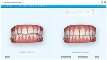 治療後のシミュレーションが可能な3D画像